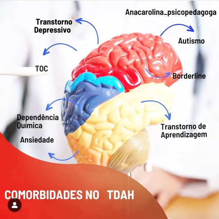 Imagem da campanha Mental Focus 60 cápsulas