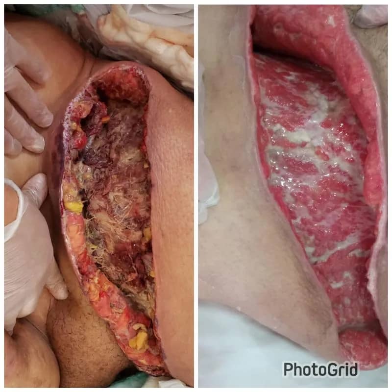 Imagem da campanha RIFA AJUDA MARILICE