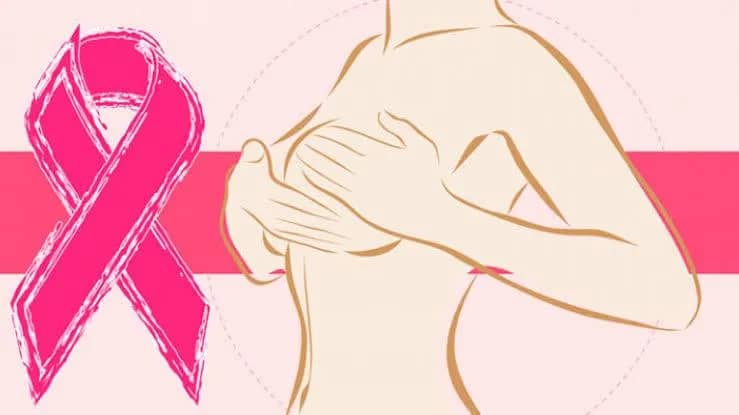 Imagem da campanha Cirurgia de câncer de mama