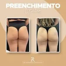 Imagem da campanha PREMIO PACOTE PREENCHIMENTO BUNBUM ( EMAGRECENTRO MAUA
