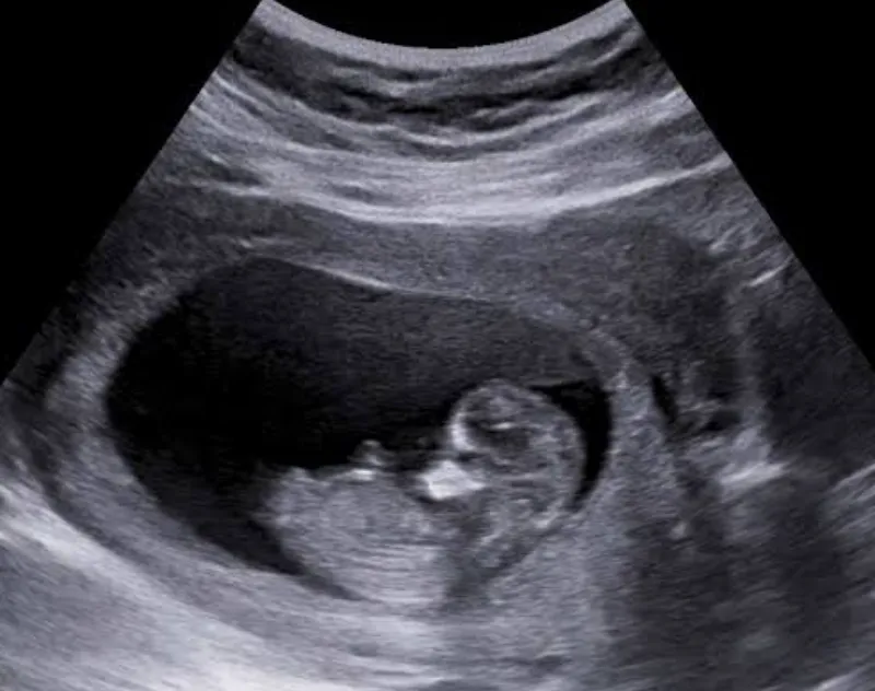 Imagem da campanha Chá de fraldas