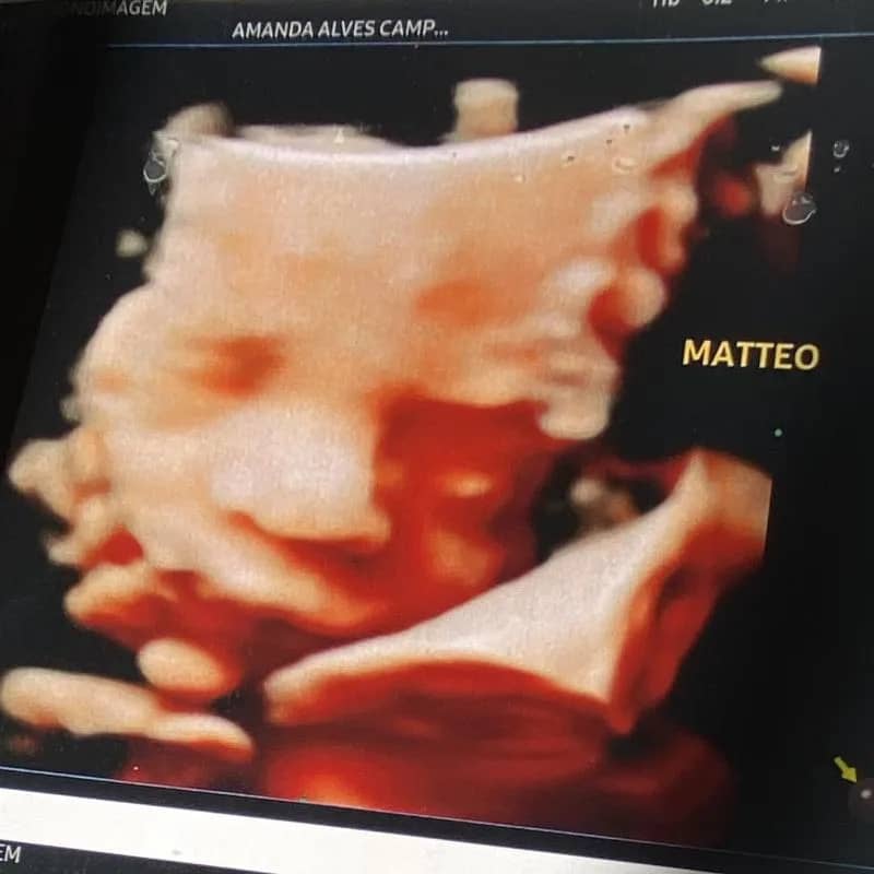 Imagem da campanha ENXOVAL DO MATTEO! 🤍