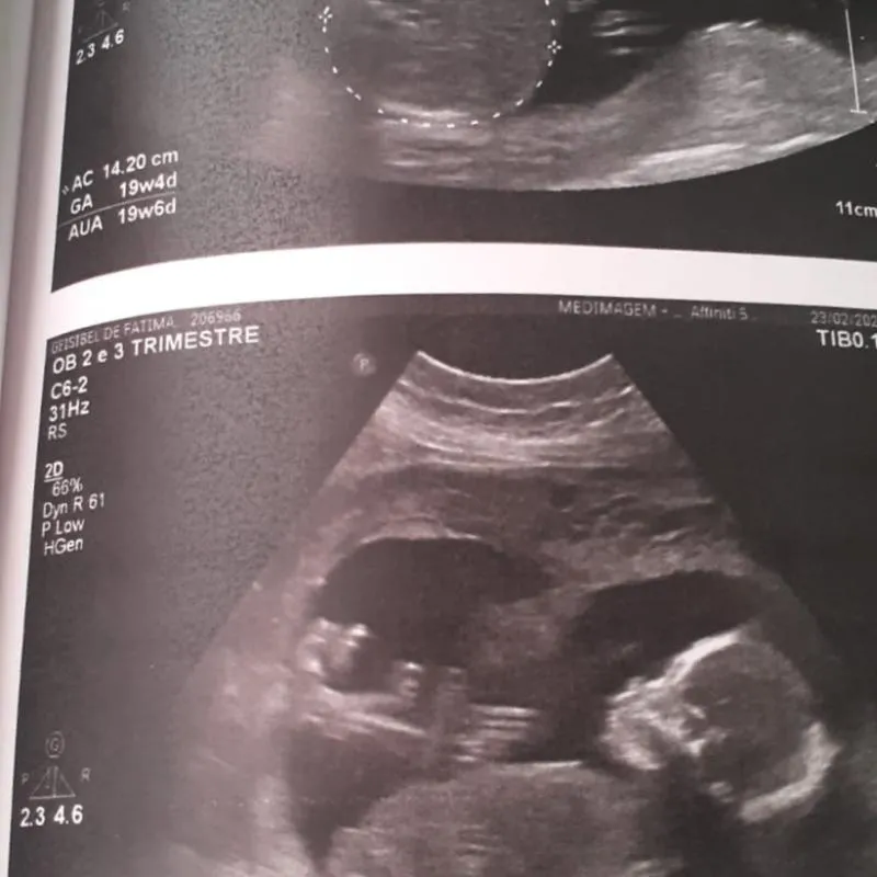 Imagem da campanha Rifa da Anthonella