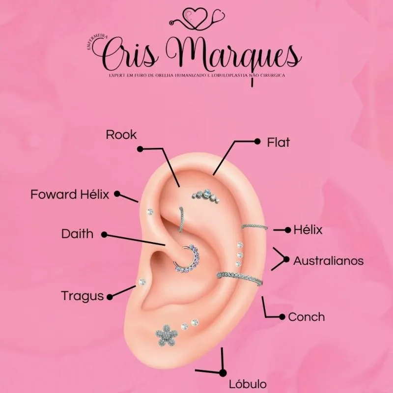 Imagem da campanha Furo humanizado ou Lobuloplastia não cirúrgica