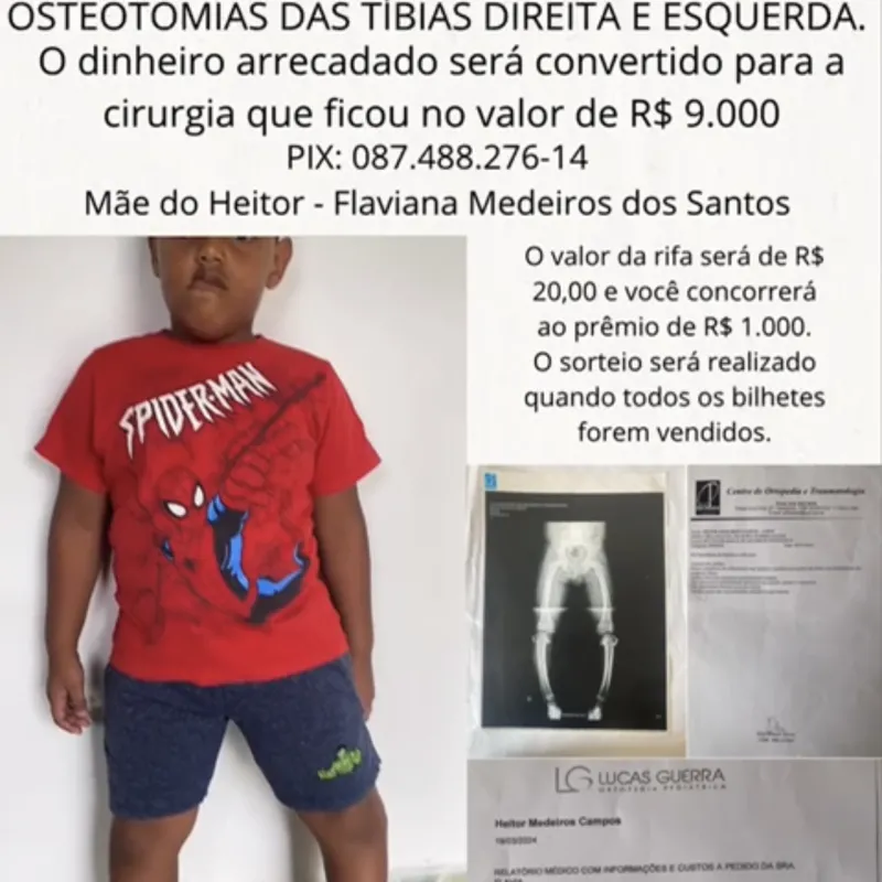 Imagem da campanha Vamos ajudar o pequeno Heitor a realizar a sua cirurgia. E você ainda concorre ao prêmio de 1.000 (mil reais)
