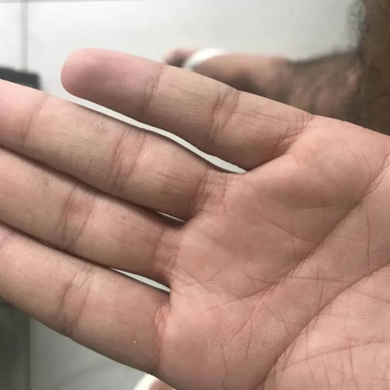 Imagem da campanha Combo Gin