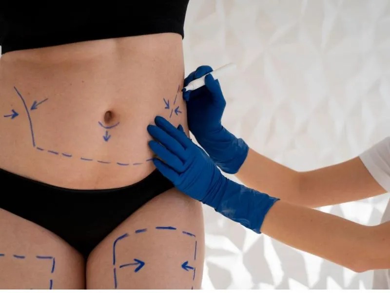 Imagem da campanha 20 mil + 1 caneta Mounjaro