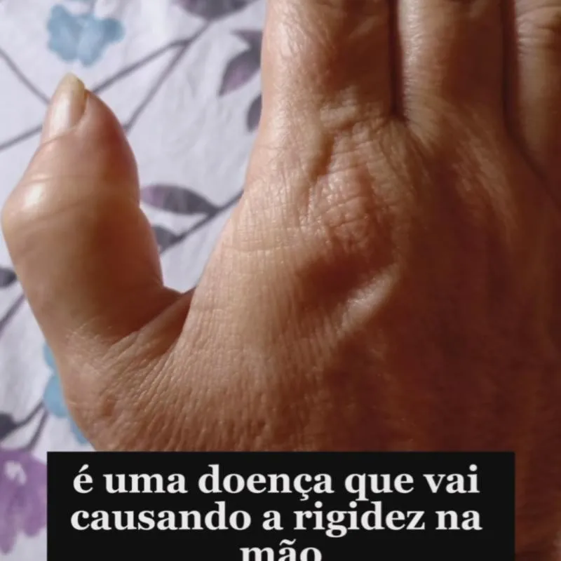 Imagem da campanha Operação da jo