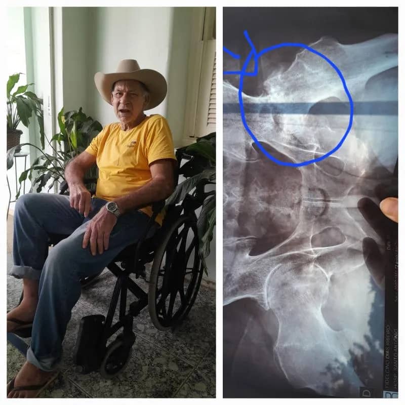 Imagem da campanha Ajude na cirurgia do sr Fidelcino prêmio pix de 200 reais