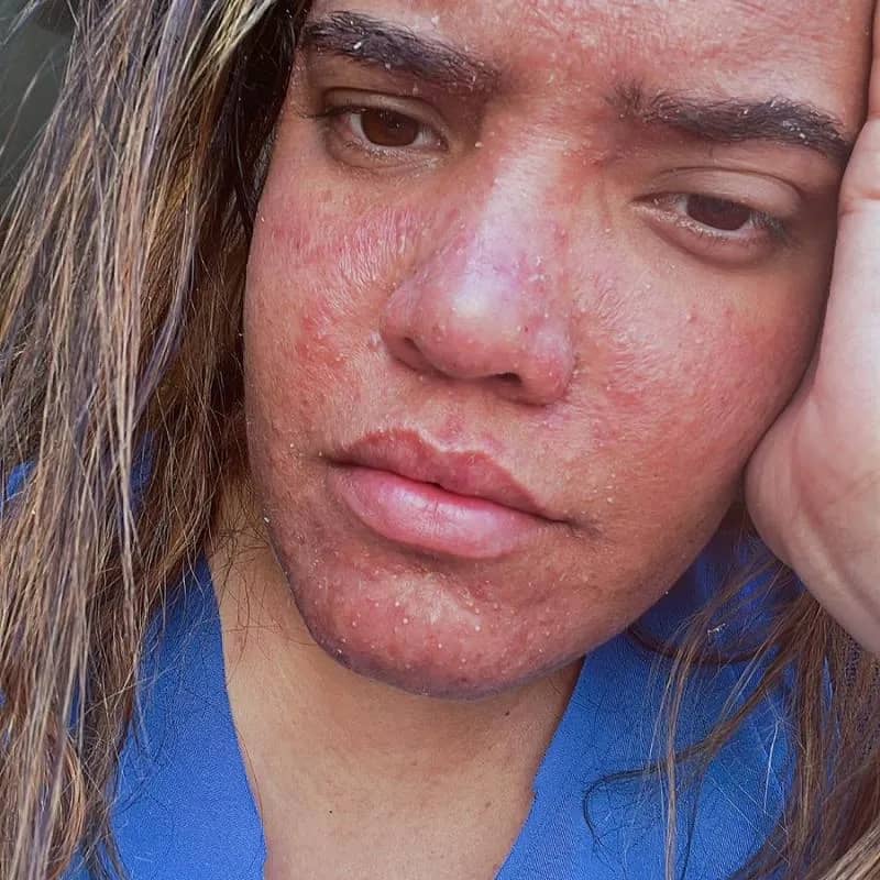 Imagem da campanha Prol da rifa