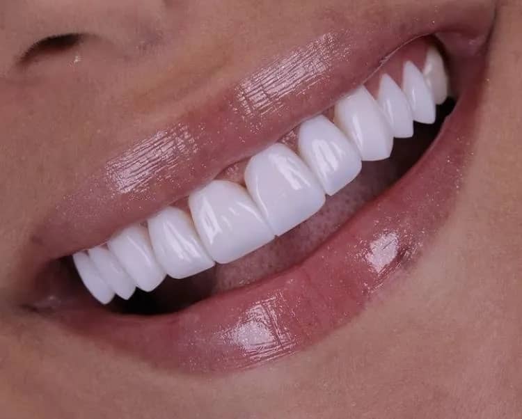 Imagem da campanha Lentes