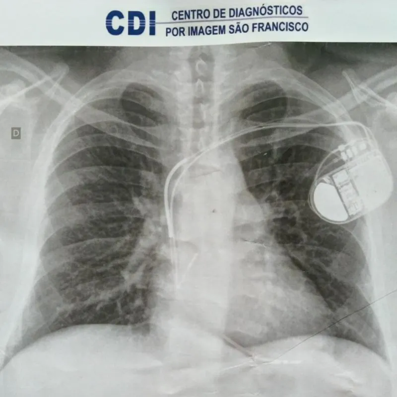 Imagem da campanha RIFA BENEFICENTE PARA A CIRURGIA DO LEANDRO