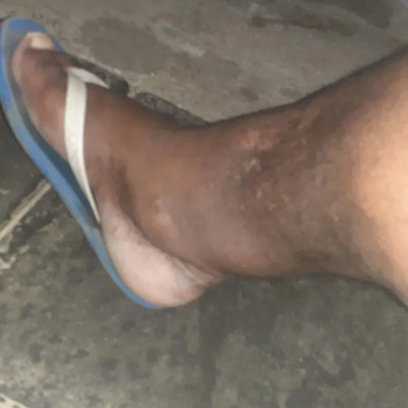 Imagem da campanha Rifa de ajuda