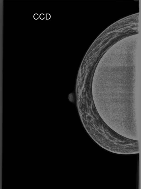 Imagem da campanha rifa solidaria