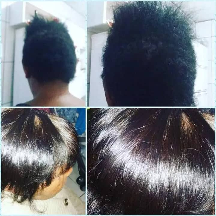 Imagem da campanha Rifa valendo aplicação de um botox capilar