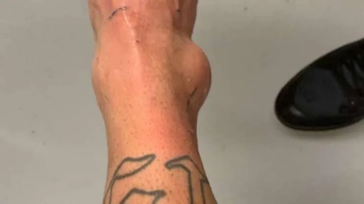 Imagem da campanha Gente to vendendo rifa para fazer uma cirurgia para tirar este caroço