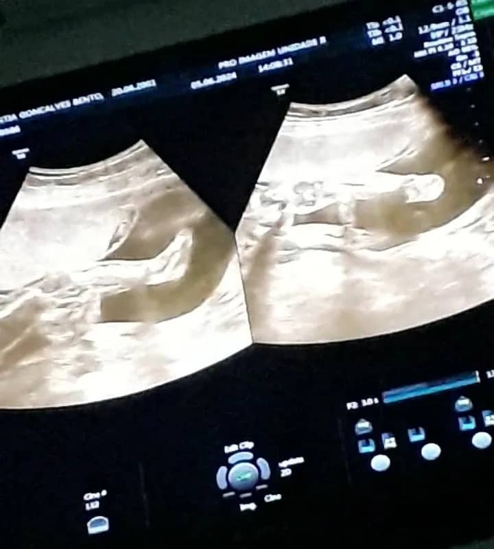 Imagem da campanha Cha de fralda, 200 no pix .