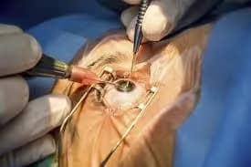 Imagem da campanha Cirurgia da Geovana