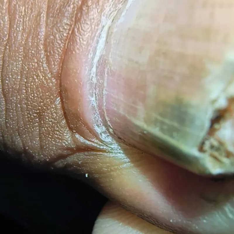 Imagem da campanha Tratamento