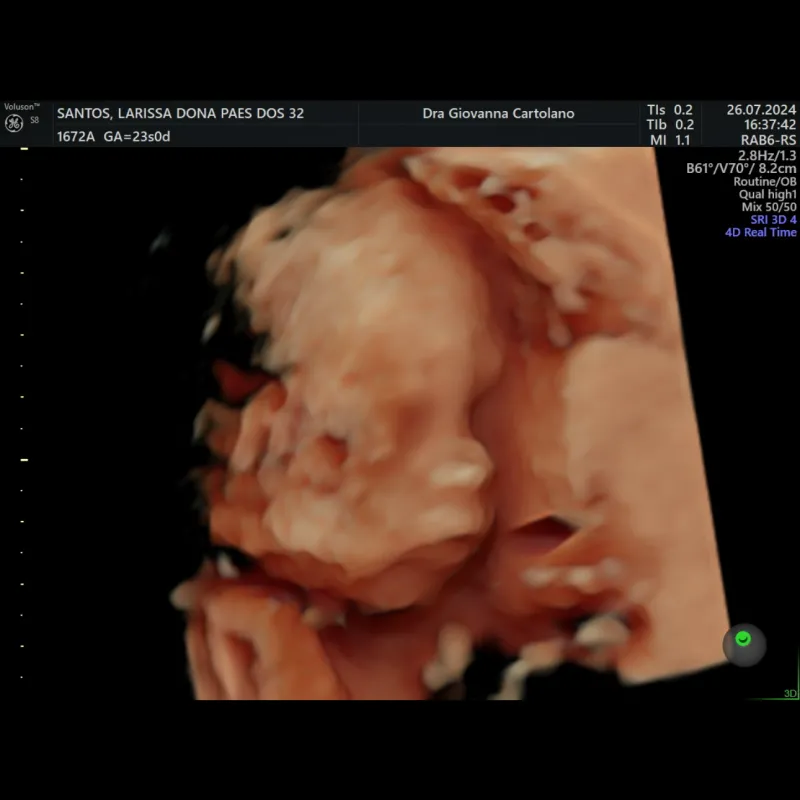 Imagem da campanha Chá fralda da Isis