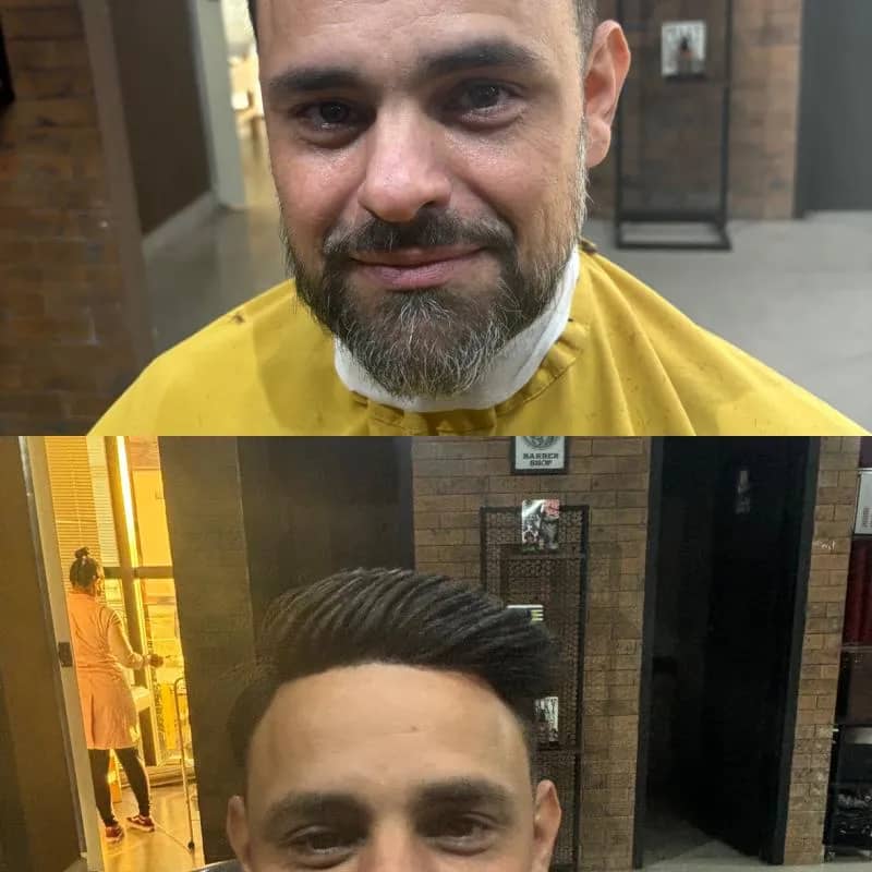 Imagem da campanha Aplicação de prótese capilar