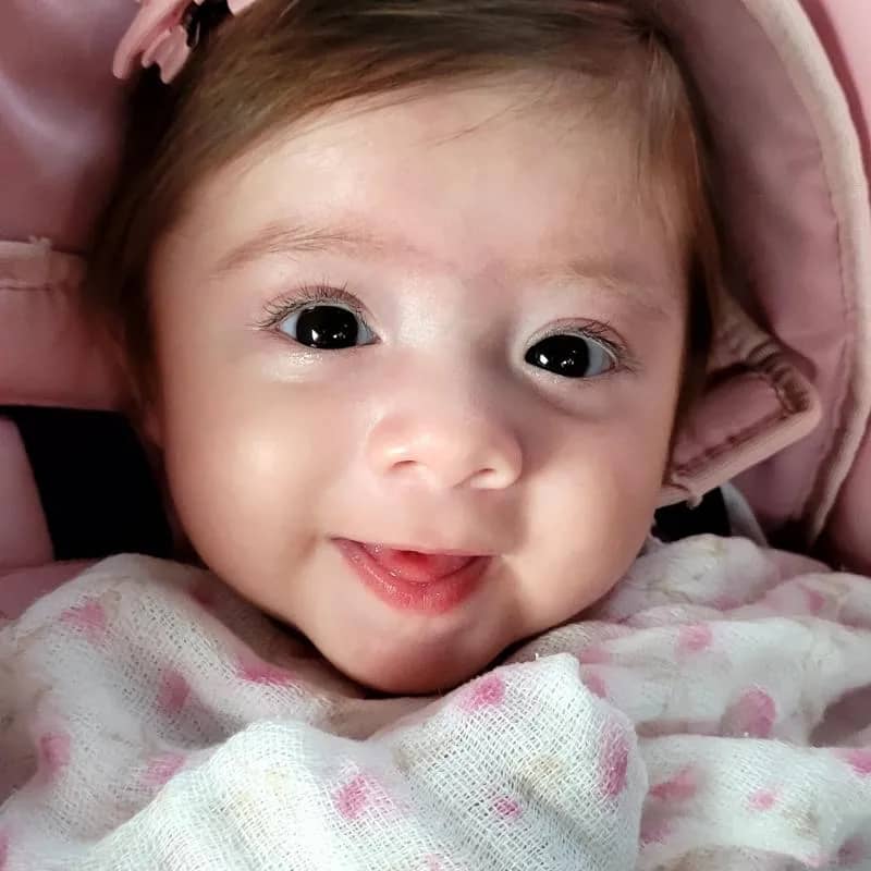 Imagem da campanha Tratamento de órtese craniana por apresentar assimétrica craniana  (Braquicefalia)