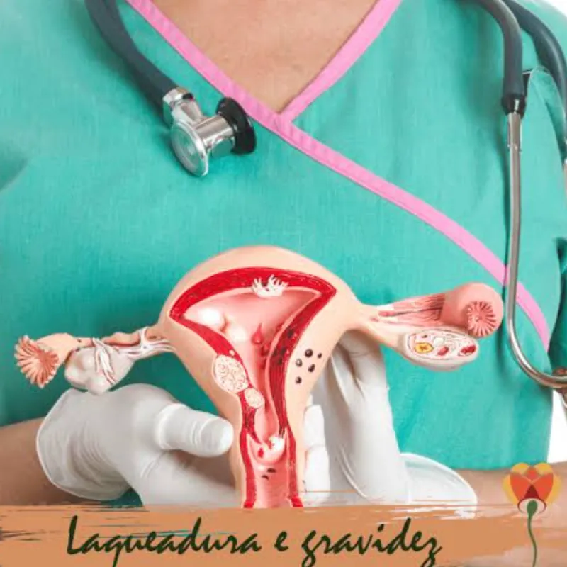 Imagem da campanha Em prol de uma laqueadura.