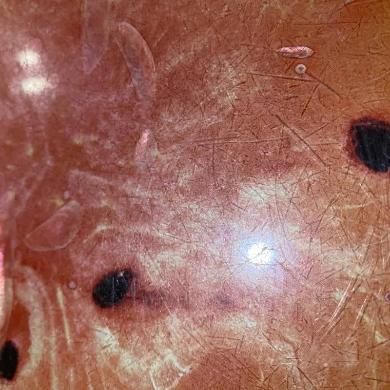 Imagem da campanha Acão do pix