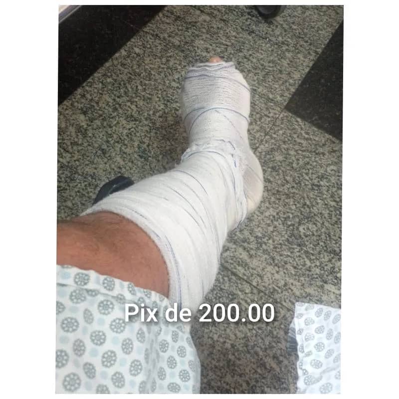 Imagem da campanha Ajuda para Aldair (fraturou o tornozelo em 2 lugares e não possui renda pra se manter no momento)