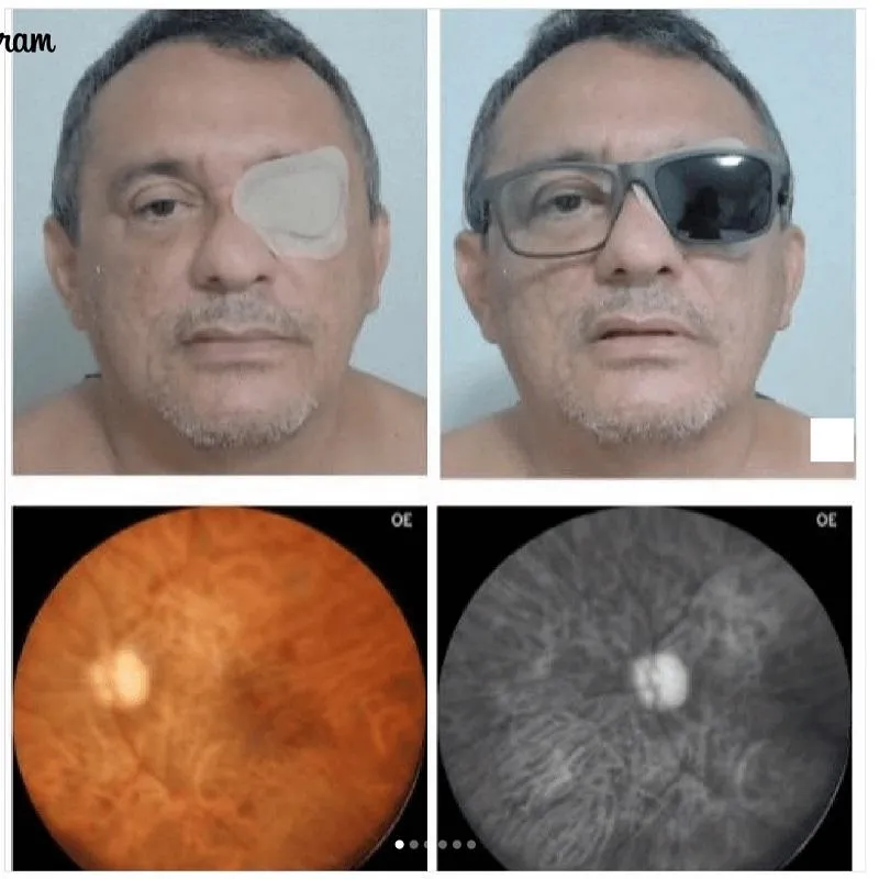 Imagem da campanha "vi.VER"!