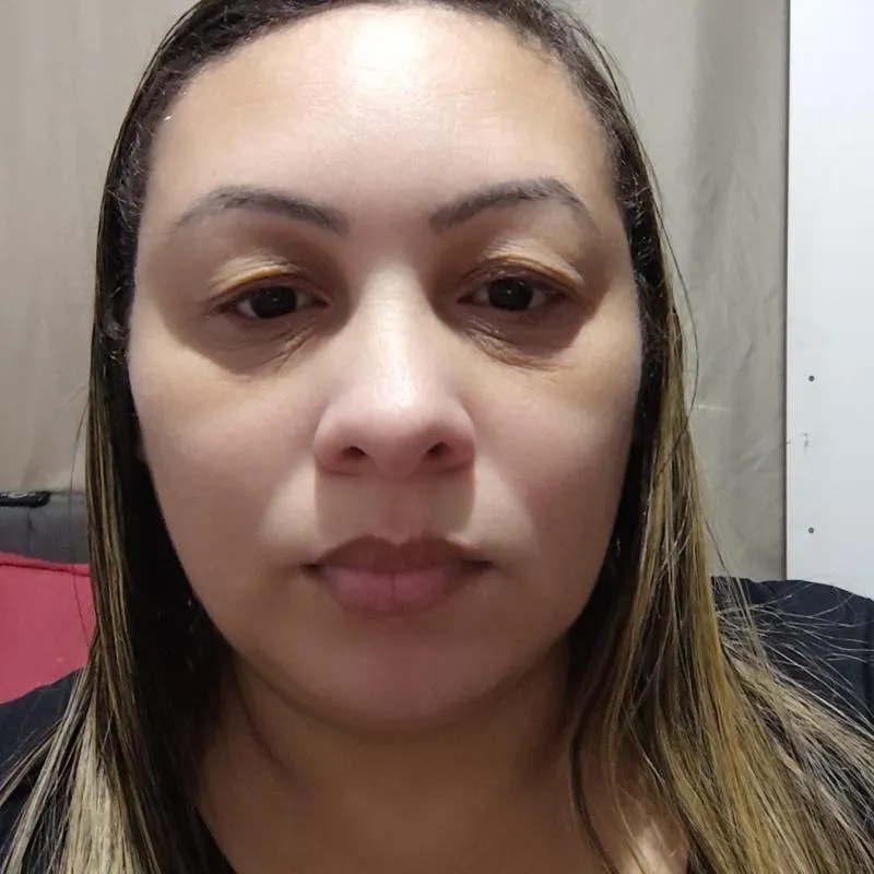 Imagem da campanha Campanha para tratamento de Ceratocone e cirurgias