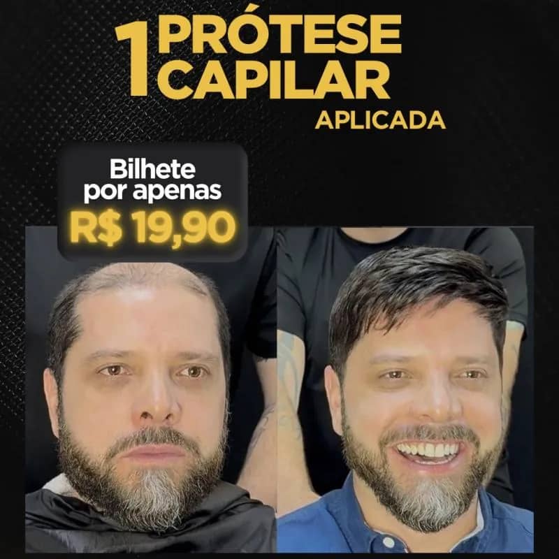 Imagem da campanha Sorteio de uma Prótese Capilar aplicada