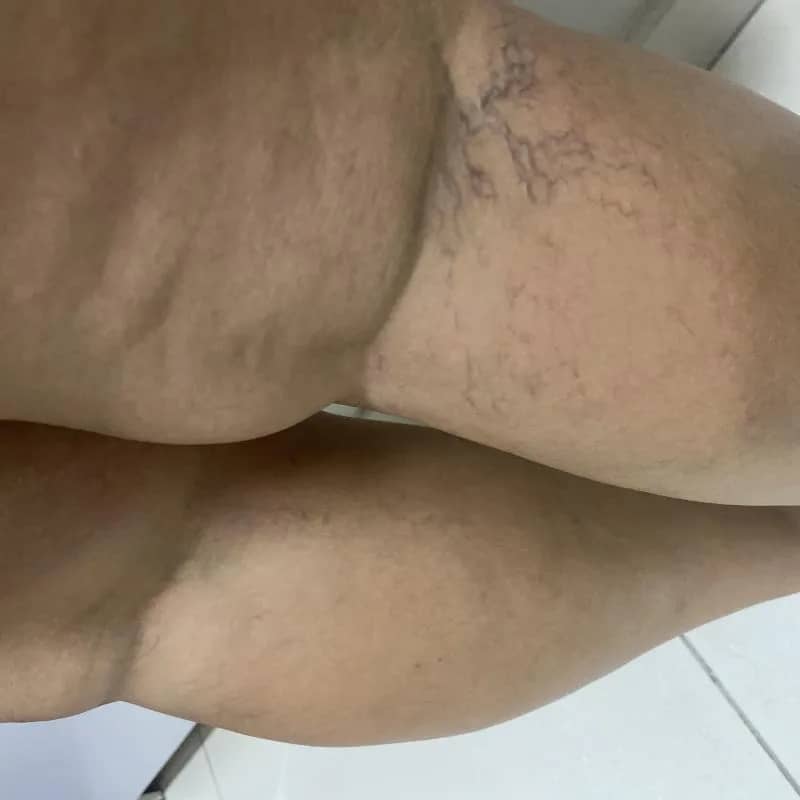 Imagem da campanha Em Prol da Cirurgia da Lorrana