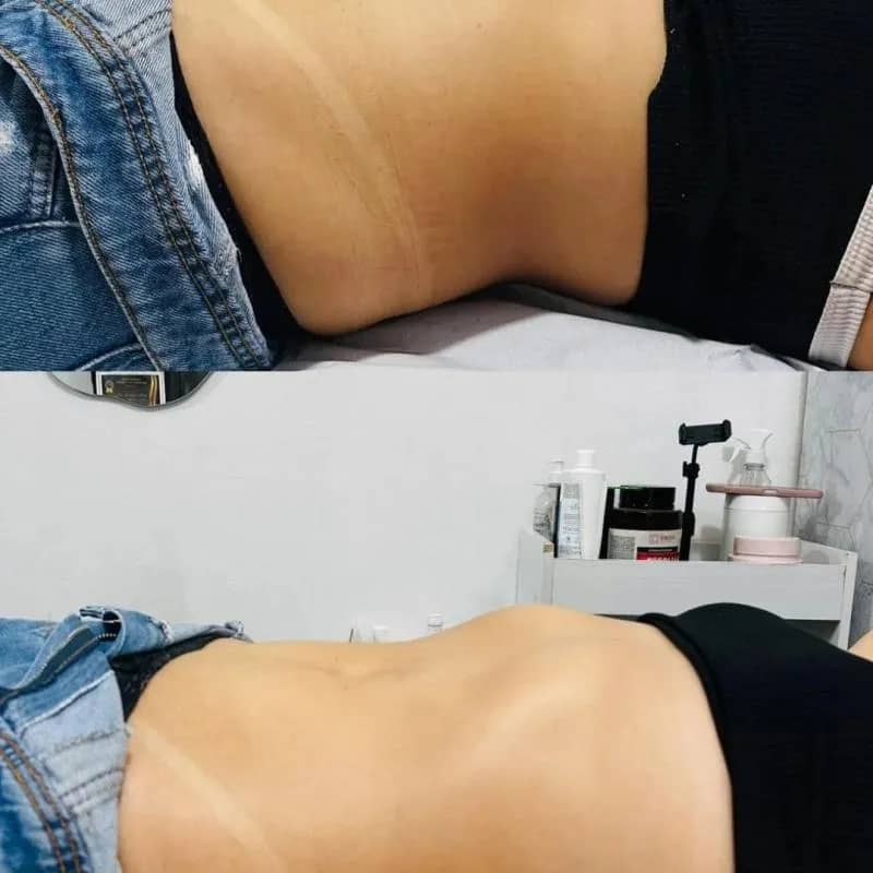 Imagem da campanha Ganhe uma Massagem HC - corpo inteiro