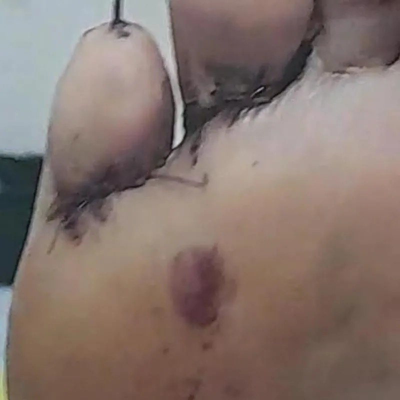 Imagem da campanha Rifa Solidária Para o Rafa