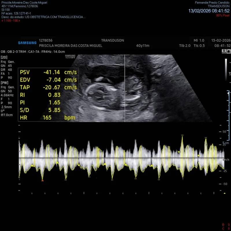 Imagem da campanha CHA RIFA ANDRE EXEMPLO