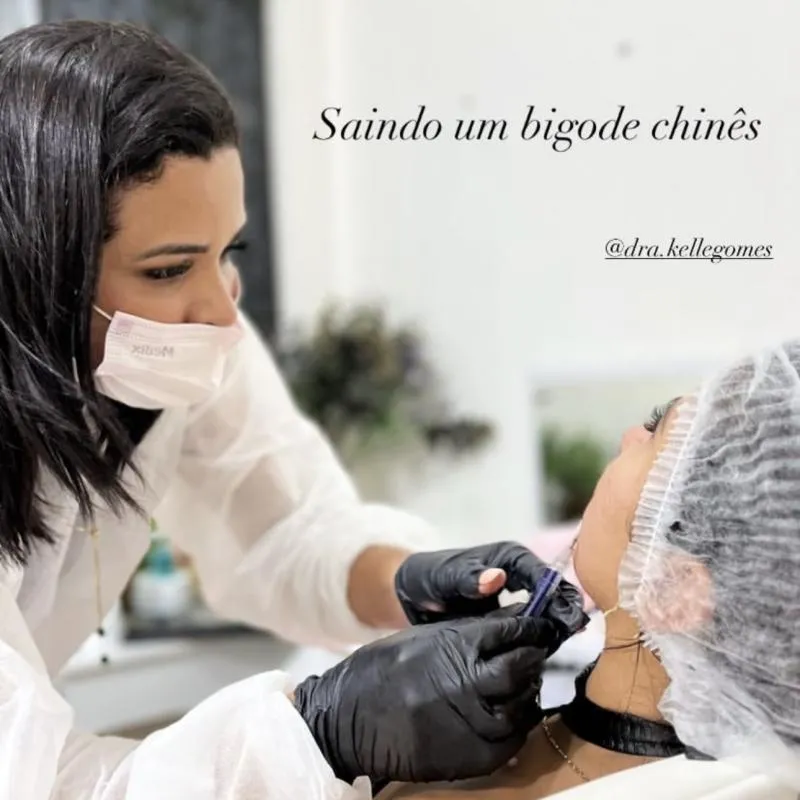 Imagem da campanha Vai ser 01 procedimento facial à escolha da ganhadora, podendo ser: • Preenchimento labial 💋 • Botox ✨ • Bigode chinês 💉