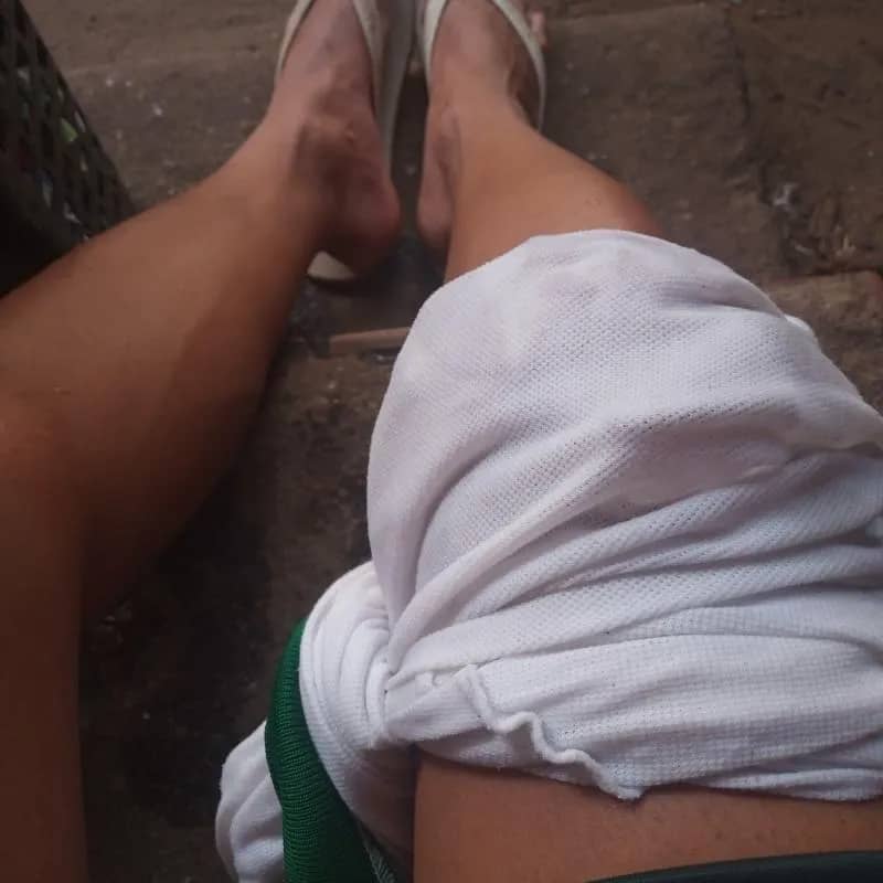 Imagem da campanha Rifa pra tratamento do joelho