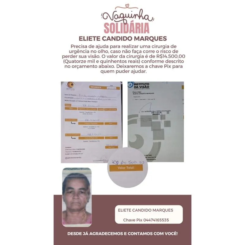 Imagem da campanha Beneficente em prol da Cirurgia Oftalmológica da Eliete