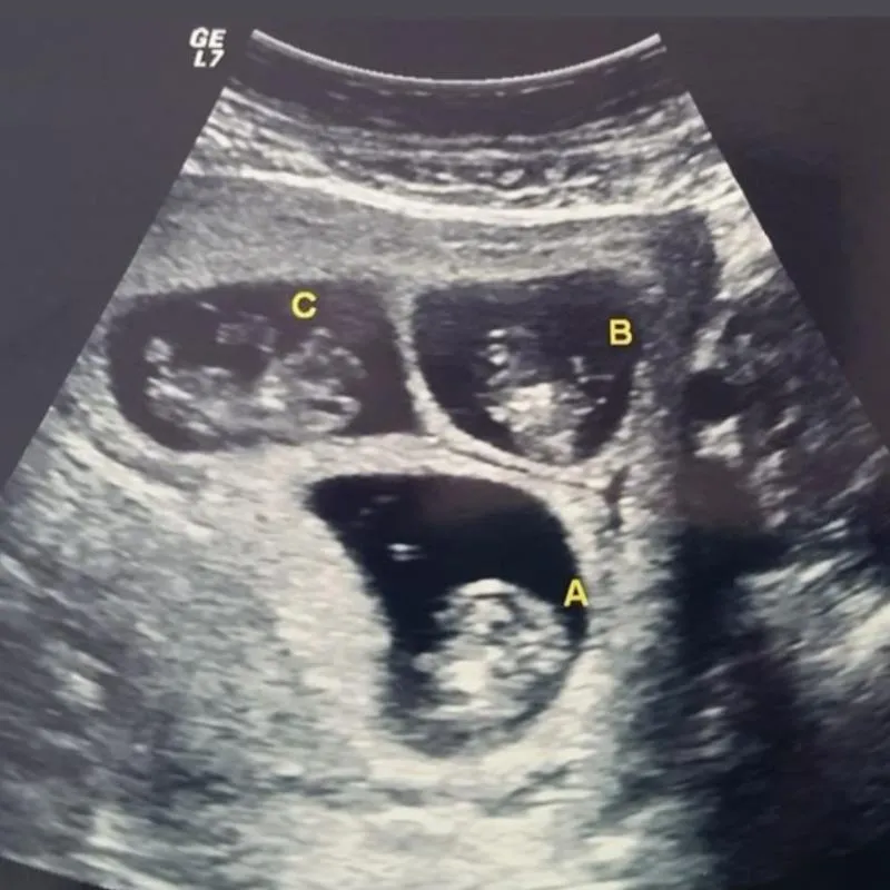 Imagem da campanha Chá fralda dos Trigêmeos